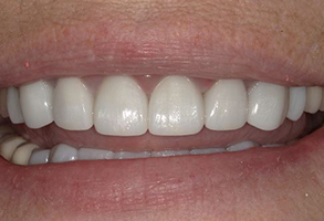 Prestige Dentistry | Periodontal Treatment, Root Canals and Dental Lab