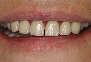 Prestige Dentistry | Dental Bridges, Periodontal Treatment and Dental Lab