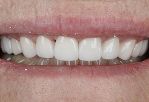 Prestige Dentistry | Dental Lab, Teeth Whitening and Air Abrasion