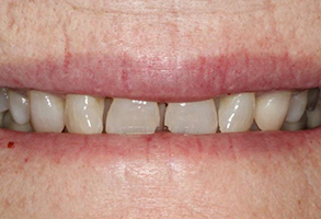 Prestige Dentistry | Preventative Program, Teeth Whitening and Oral Exams