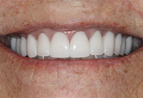 Prestige Dentistry | Cosmetic Dentistry, CBCT and Digital Radiography