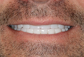 Prestige Dentistry | Sleep Apnea, Ceramic Crowns and Emergency Treatment