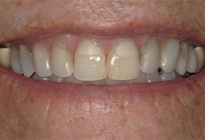 Prestige Dentistry | Implant Restorations, Snoring Appliances and CEREC