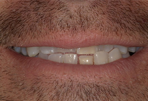 Prestige Dentistry | Implant Dentistry, Teeth Whitening and Emergency Treatment