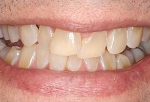 Prestige Dentistry | CBCT, All-on-6 reg  and Night Guards