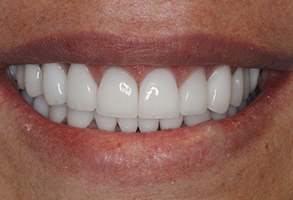 Prestige Dentistry | Pediatric Dentistry, Veneers and CEREC