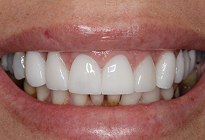 Prestige Dentistry | Emergency Treatment, Ceramic Crowns and Laser Dentistry
