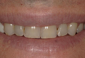 Prestige Dentistry | ClearCorrect reg , CBCT and Teeth Whitening