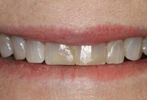 Prestige Dentistry | Laser Dentistry, Cosmetic Dentistry and Preventative Program