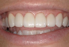 Prestige Dentistry | Night Guards, Oral Cancer Screening and Emergency Treatment