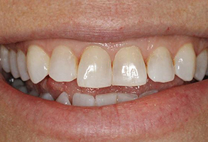 Prestige Dentistry | Teeth Whitening, Digital Radiography and Veneers