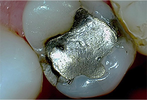 Prestige Dentistry | All-on-6 reg , Oral Exams and Oral Cancer Screening