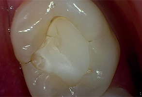 Prestige Dentistry | Smile Makeovers, Implant Dentistry and Dental Sealants