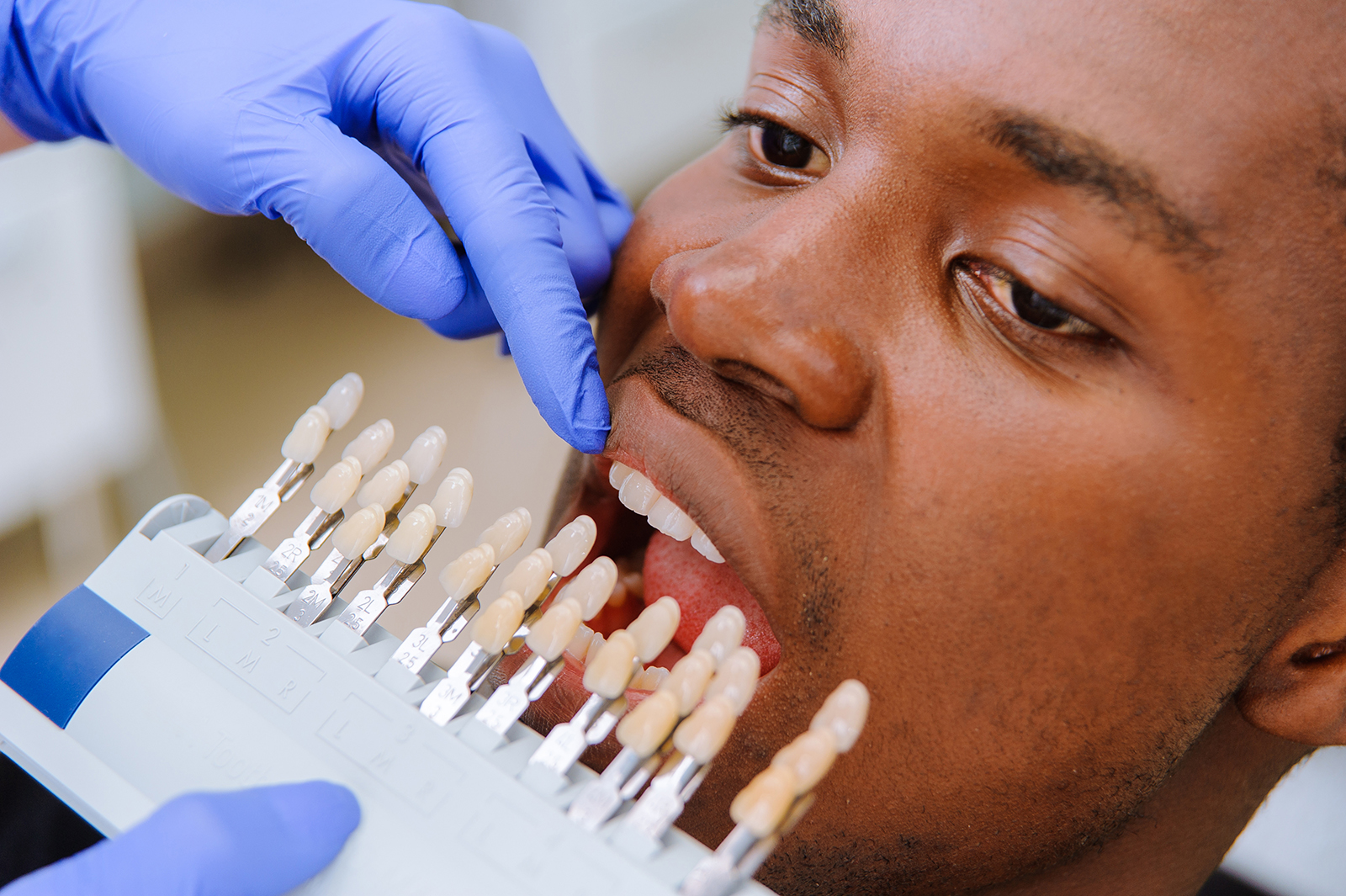 A man receiving dental care while wearing blue gloves, with his mouth open over a device that appears to be an electric toothbrush.