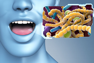 The image shows a 3D rendering of a human head with an open mouth, displaying a microscopic view of bacteria within a cellular environment, which includes a nucleus and other biological structures. A speech bubble containing an image of the bacteria floats above the open mouth.