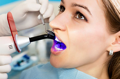 The image shows a woman sitting in a dental chair with a blue mouthpiece inserted into her mouth, which appears to be part of a dental examination or cleaning process. She is being attended to by a professional wearing medical gloves and using a dental instrument.