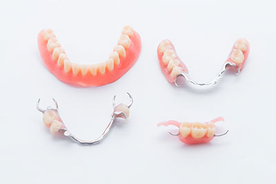 The image shows a collection of red dental braces with metal clasps, displayed against a white background on a table.