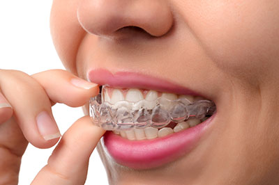 The image features a person with an orthodontic appliance, such as braces or aligners, adjusting their teeth while smiling at the camera.