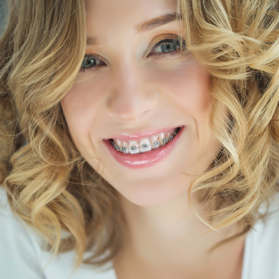 The image features a woman with braces smiling at the camera.
