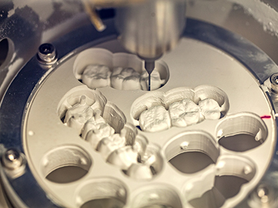 The image shows a microscopic view of a dental implant with a metal post being machined by a precision drill, capturing the intricate process of creating a dental implant.